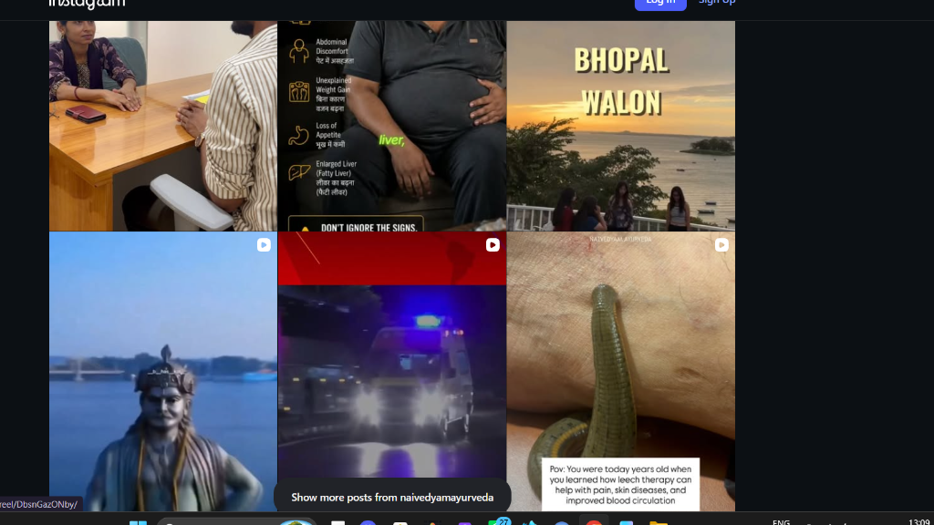 Leech Therapy in Bhopal